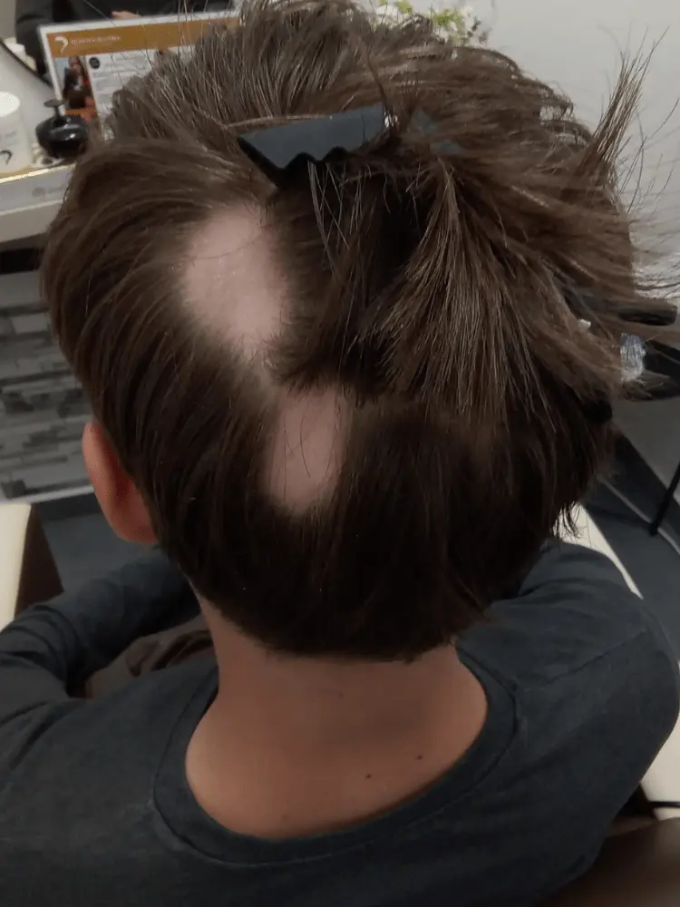 Foto před